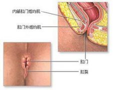 福州治疗肛裂哪家医院好