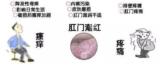尴尬的痛苦——肛门瘙痒该怎么办?